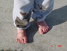 Hunter's muddy feet
