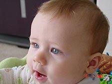 Hunter with his new teeth.