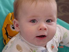 Hunter with his bottom teeth.